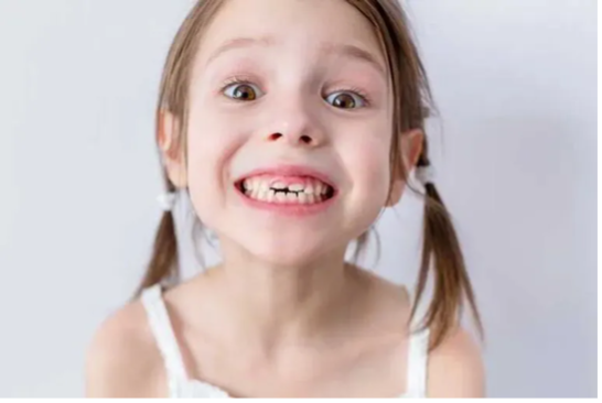 Niña sonriendo después de la caída natural de un diente de leche, etapa normal del desarrollo dental infantil.