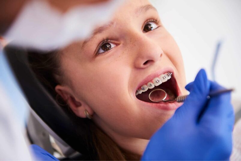 Paciente infantil durante una valoración de ortodoncia en Palmira con brackets metálicos realizada por un ortodoncista.
